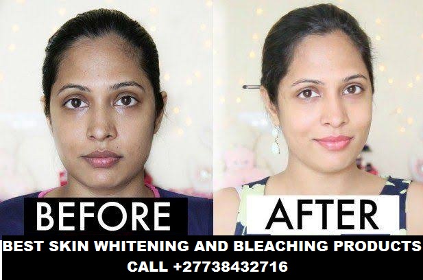 Permanent Skin Lightening Skin Whitening Products +27738432716