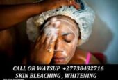 Permanent Skin Lightening Skin Whitening Products +27738432716